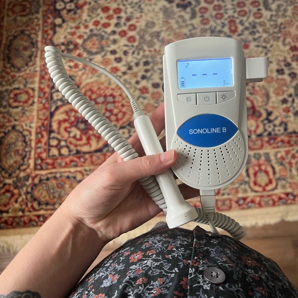 Sonoline B fetal Doppler